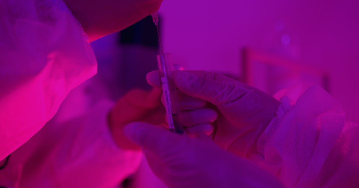 哪个平台做外汇开户好些